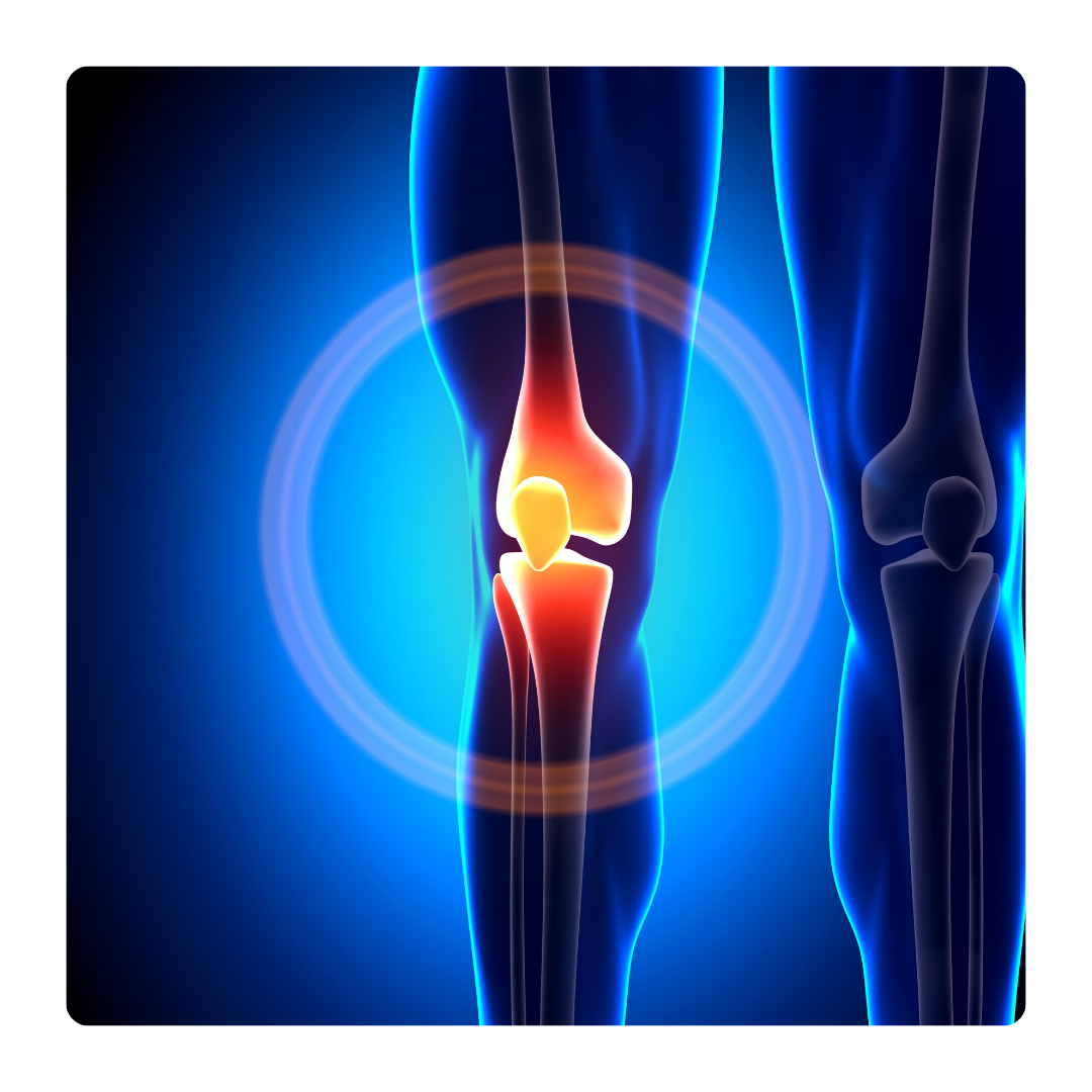 Joints. They're Holding It All Together.